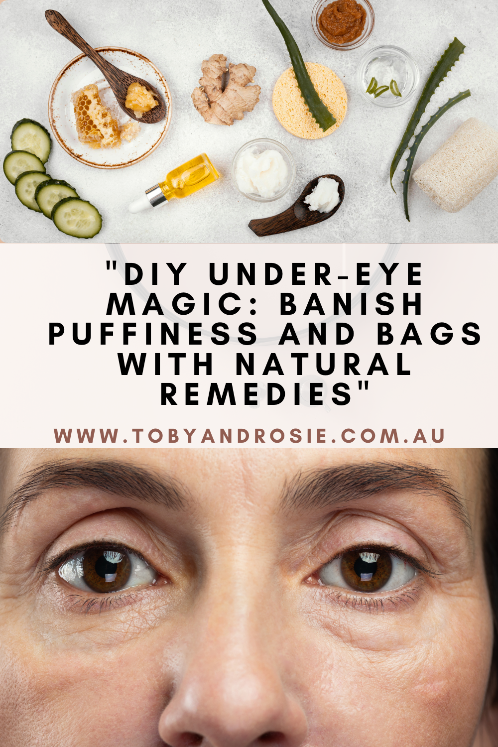 Frequently Asked Questions of how to reduce eye puffiness naturally