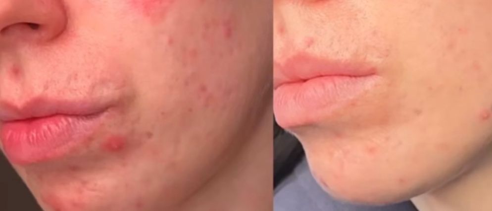 ✨Tallow &amp; Blue Lotus Facial Balm – The Ultimate Day &amp; Night Skin Transformer✨